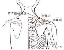 精确定位肩井穴